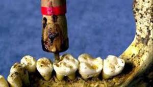 Зъболекарската машинка в дълбока древност