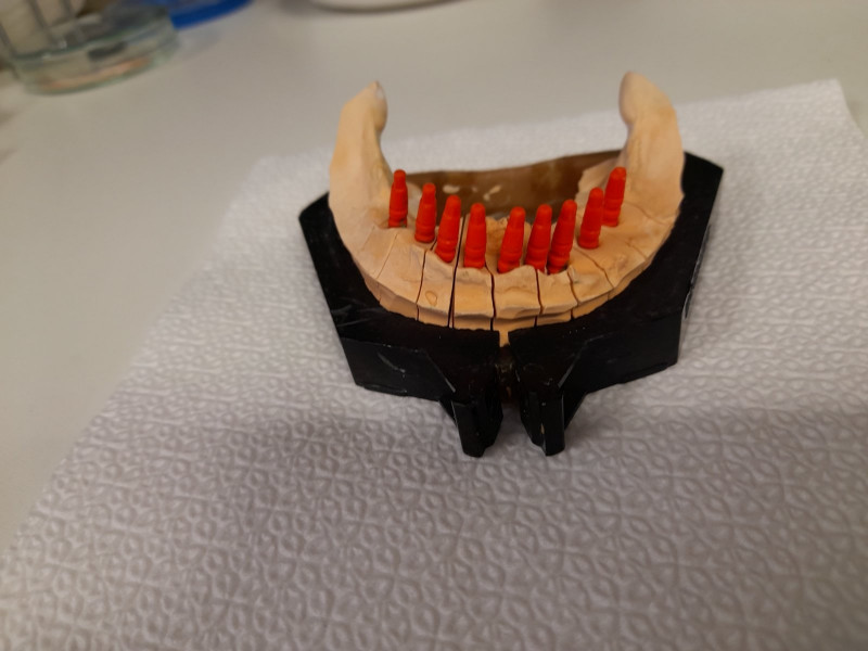 [/userfiles/files/04-cortico-basal-implants.jpg]