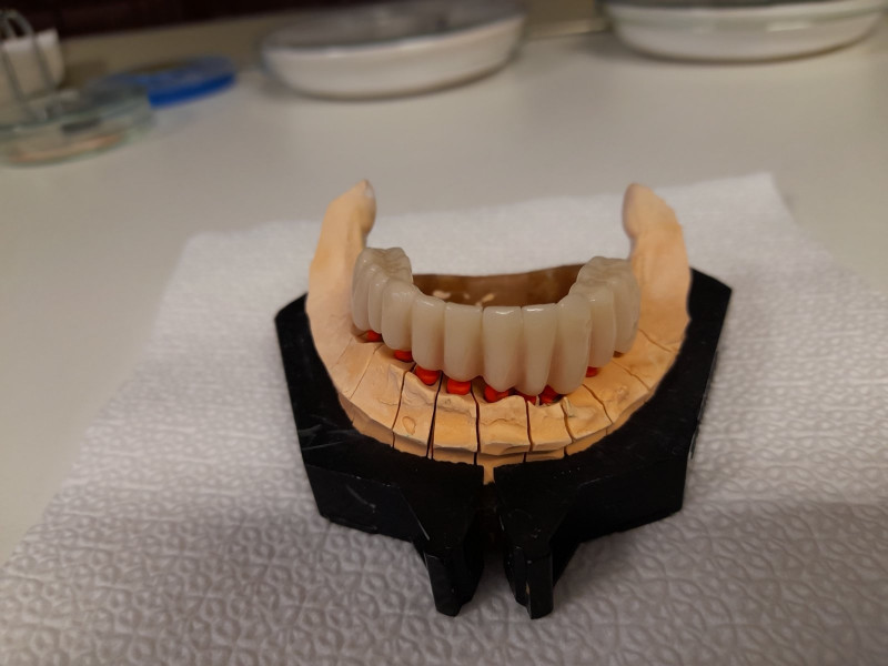 [/userfiles/files/07-cortico-basal-implants.jpg]