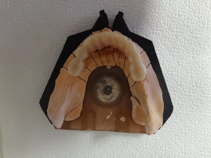 [/userfiles/files/08-cortico-basal-implants-1.jpg]