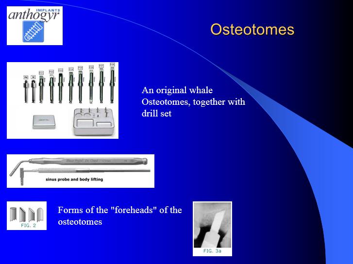 [/userfiles/files/Bone-Implantation-8.jpg]