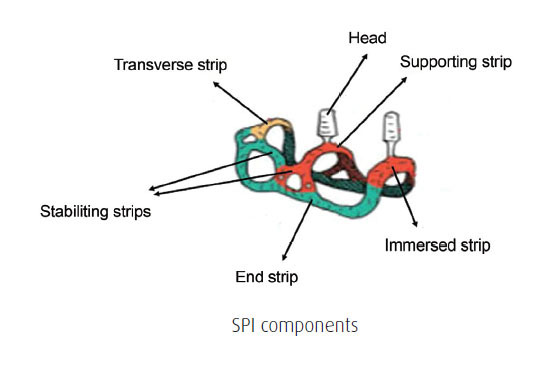 [/userfiles/files/SPI%20components.jpg]